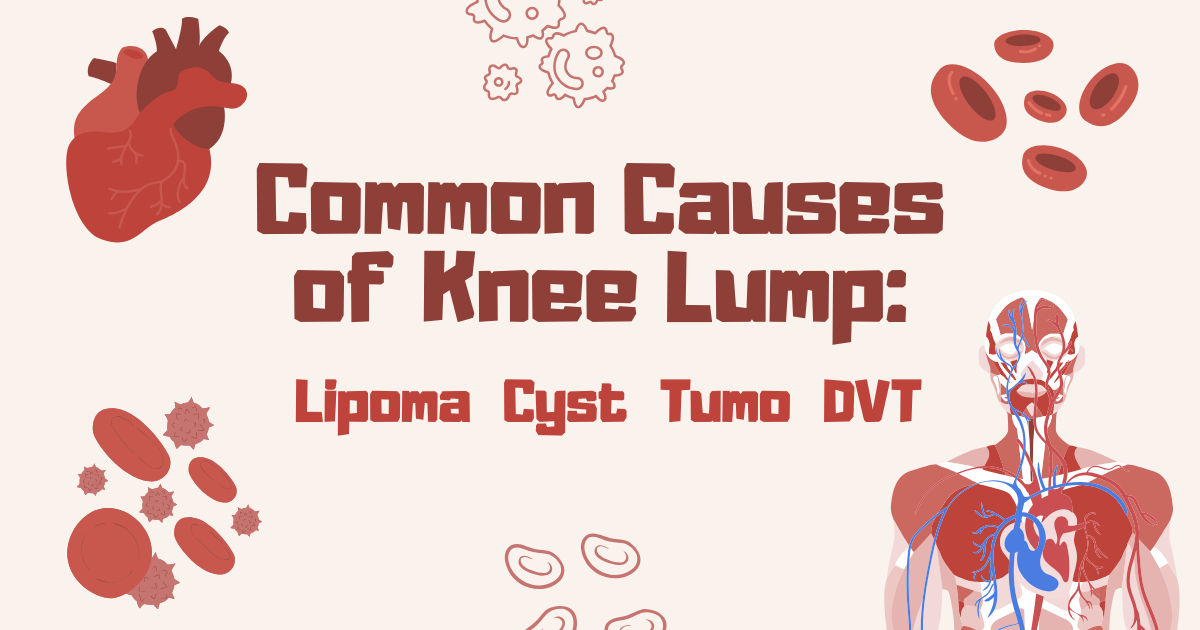 Common Causes of Knee Lump