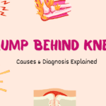 lump behind knee not baker's cyst